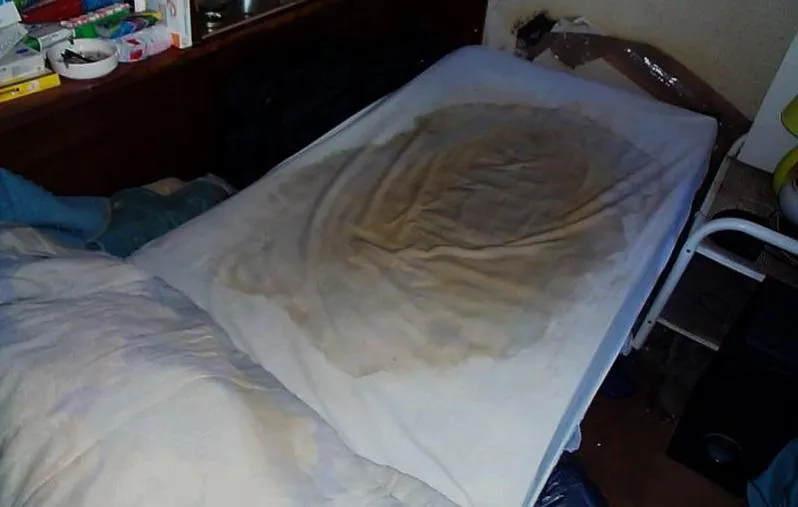 How to stop bedwetting in both children and adult permanently