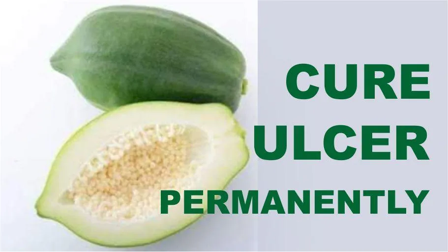 Cure Ulcer Permanently, causes and Signs